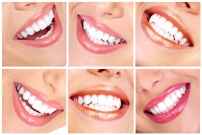 smile makeover dentist