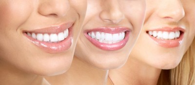 beautiful smiles dental care