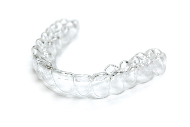 clear aligners