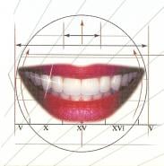 beautiful world class porcelain smile makeover with a cosmetic dentist using veneers