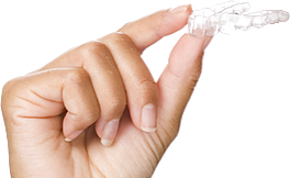 clear aligner